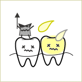 虫歯菌の攻撃や胃酸に晒される歯